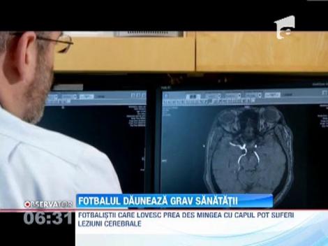 Lovitul mingii de fotbal cu capul poate provoca leziuni cerebrale