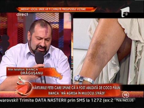 Bianca Dragusanu, despre fostul ei iubit violent: "Retraiesc tot ce am patit acum 10 ani. Mi-e frica sa ies din casa!"