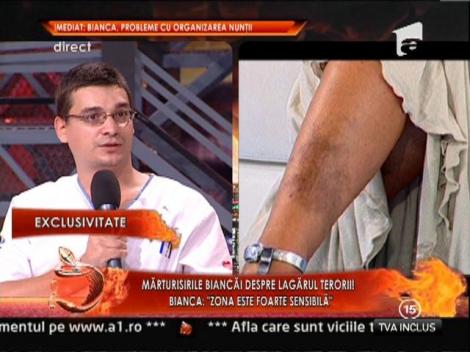 Bianca Dragusanu: "Un an de zile m-a batut in aceleasi locuri