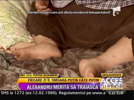 IMAGINI SOCANTE! / La 6 ani, are de 4 ori greutatea normala a unui copil de varsta lui!