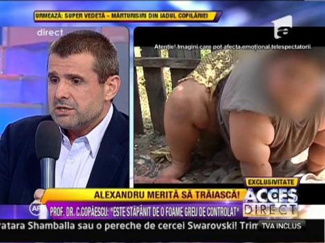 Doctorul Catalin Copaescu, despre baiatul diagnosticat cu obezitate morbida din Dolj: "Poate manca pana la explozia stomacului!"