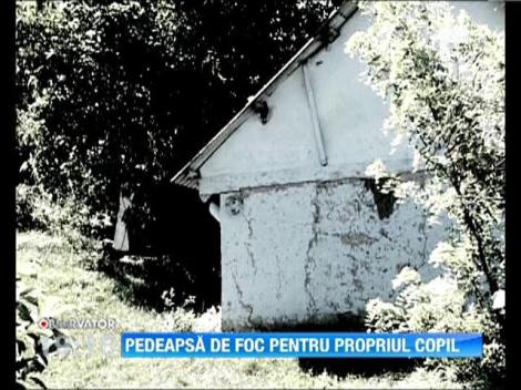 Un barbat din Vaslui si-a pedepsit fiul intr-un mod infiorator. L-a fortat sa stea cu mana in foc!
