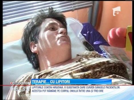 Hirudoterapia, terapia cu ajutorul lipitorilor