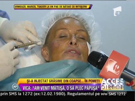 Vica Blochina si-a injectat grasime proprie in obraji