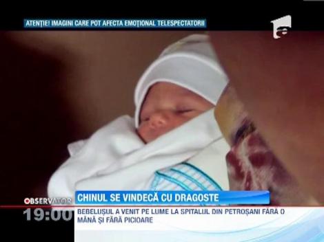 Luca, bebelusul care s-a nascut fara o mana si fara picioare, a ajuns acasa