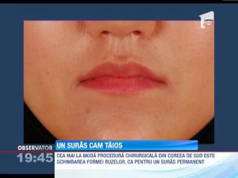 Pentru a detine un zambet permanent, tinerele din Coreea de Sud apeleaza la bisturiu