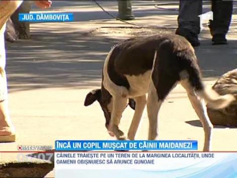 Dambovita: Un copil de 3 ani muscat de fata si de cap de un caine maidanez