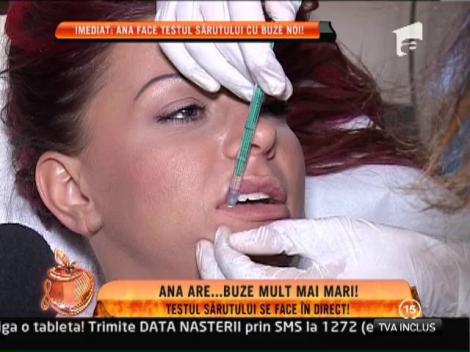 Ana Maria Mocanu si-a pus acid hialuronic in buze