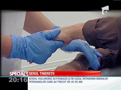 Esteticienii au lansat un nou tip de acid hialuronic pentru intretinerea pielii mainilor