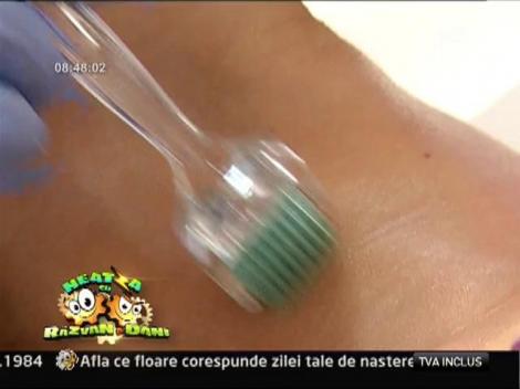 Buna dimineata, sanatate! Rejuvenarea gatului