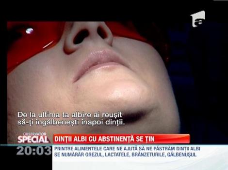 Tot ce nu stiai despre albirea dintilor