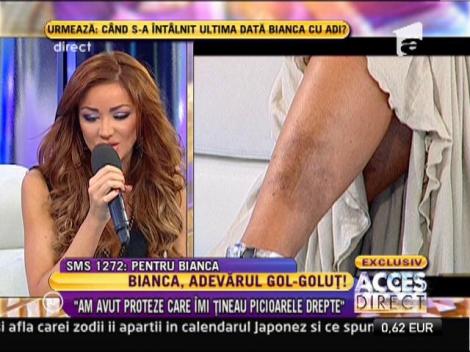 Bianca: "Voi mai face şi alte intervenţii, dar mă voi consulta şi la un alt doctor"