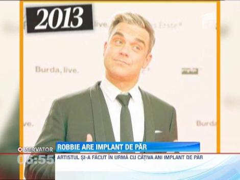 Robbie Williams şi-a făcut implant de păr