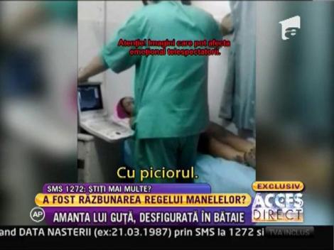 Amanta lui Guţă, desfigurată în bătaie: "Mi-au dat cu pumnii în cap!"