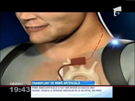 Prima inimă artificială a fost implantată cu succes unui pacient