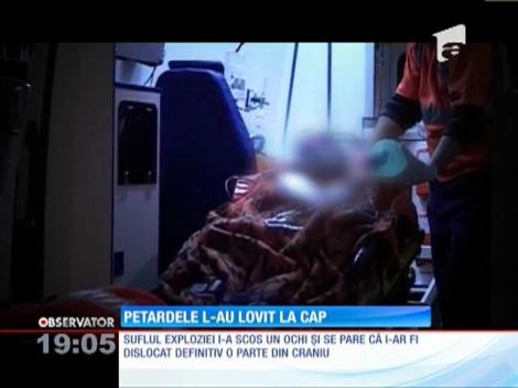 Bărbat mutilat de o petardă