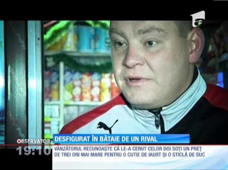 UPDATE / Desfigurat de un luptător k1