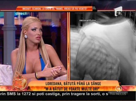 Loredana Chivu, bătută până la sânge: "M-a dat cu capul de pat şi mi-a spart arcada"