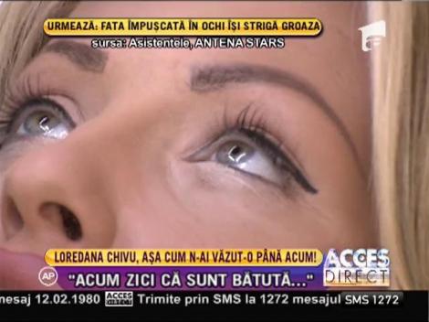 Loredana Chivu și-a făcut o nouă operație estetică!