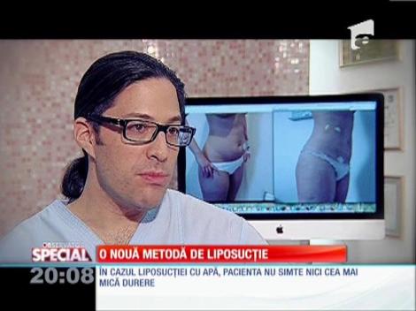 Special! O nouă metodă de liposucţie