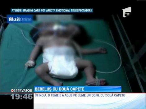 Un bebeluş cu două capete s-a născut în India!