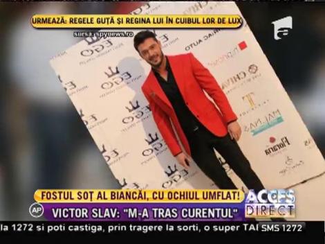 Victor Slav, cu ochiul umflat la un eveniment monden