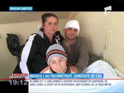 Elvis Romeo, tânărul căruia medicii i-au reconstruit jumătate de cap