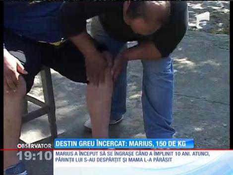 Are 17 ani şi 150 de kilograme! Un copil din Dolj trece prin dureri cumplite, din cauza obezităţii