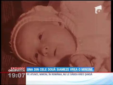 Gherghina, una din cele două siameze, vrea o minune