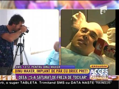 Dinu Maxer și-a făcut implant de păr