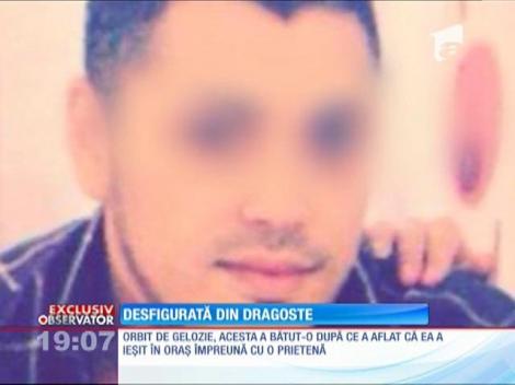 O tânăra din București, desfigurată din dragoste