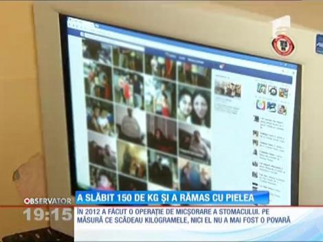 Marius Stoica a slăbit 150 de kilograme, dar acum are exces de piele