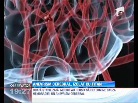 Anevrism cerebral, izolat cu titan