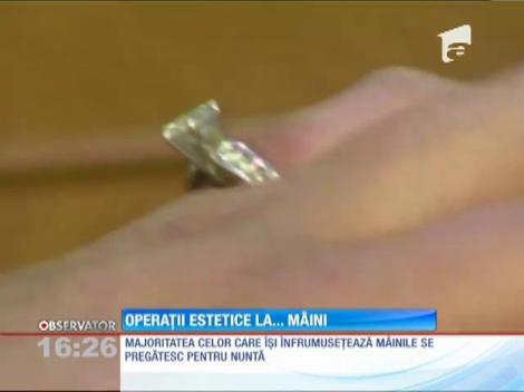 Operaţii estetice la... mâini