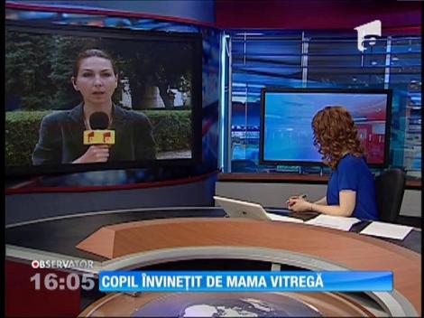Copil învineţit de mama vitregă