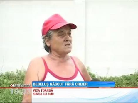 Un bebeluş uimeşte lumea medicală! S-a născut fără o bună parte din creier