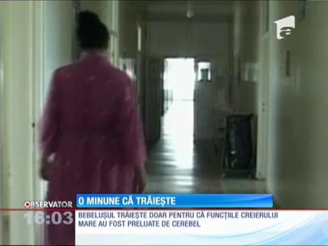 Un bebeluş frumos ca un înger a venit pe lume fără creierul mare