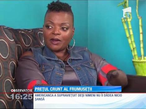 A ajuns fără mâini şi fără picioare, după ce a apelat la un fals medic estetician!