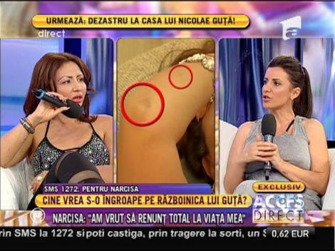 Narcisa lui Guţă s-a automutilat!