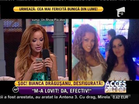 Momente de groază! Bianca Drăguşanu a avut un ȘOC atunci când s-a văzut cu fața desfigurată