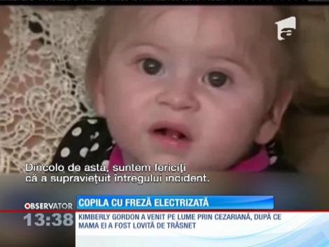 O copilă din Statele Unite a scăpat cu viaţă după ce a fost lovită de trăsnet