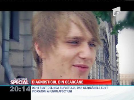 Ce se poate ascunde în spatele cearcănelor