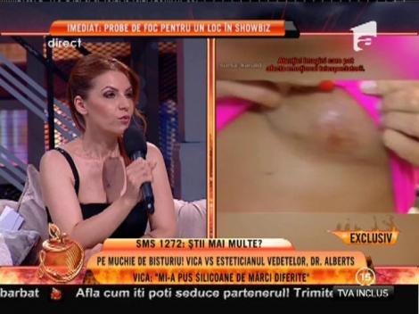 Mirela Dinică: ”Sunt dependentă de acid hialuronic”