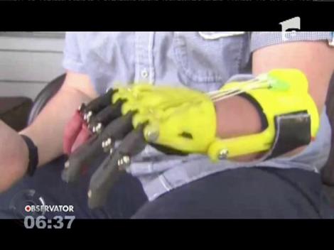 Proteze performante fabricate cu ajutorul imprimantei 3D