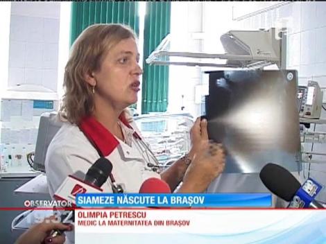 Două fetiţe siameze au venit pe lume la maternitatea din Braşov