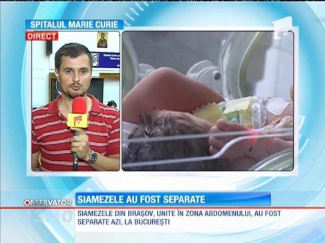 Siamezele din Braşov unite în zona abdomenului au fost separate