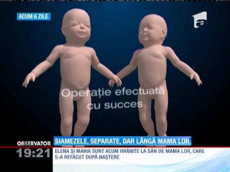 Siamezele despărţite sunt l&acirc;ngă mama lor