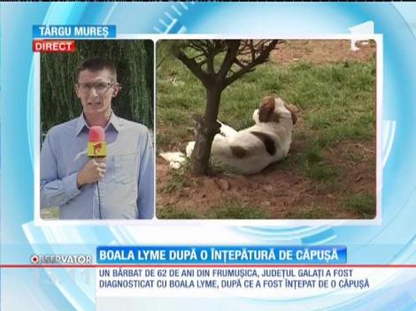 Român diagnosticat cu boala Lyme, după o înţepătură de căpuşă