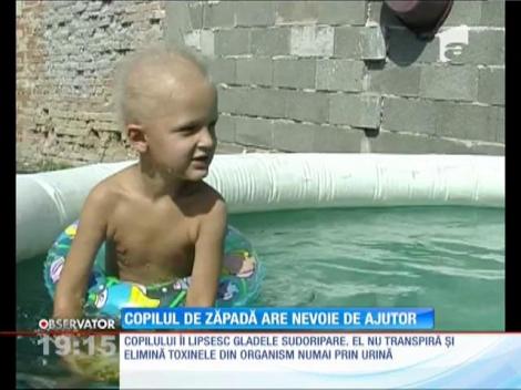 Un băieţel de patru ani s-a născut fără glande sudoripare! NU transpiră niciodată