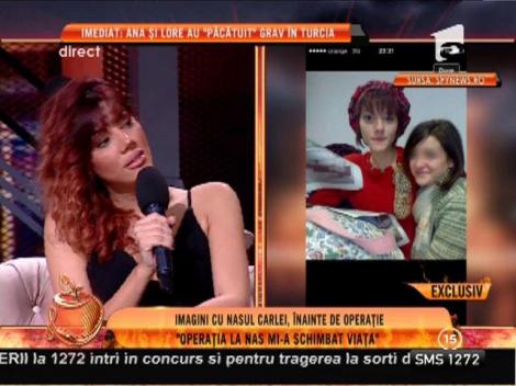 Imagini cu nasul Carlei, înainte de operație!